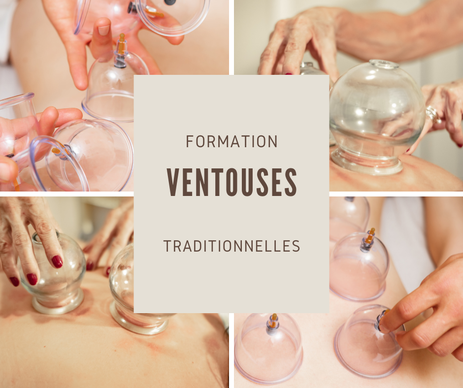 Formation à l’application des ventouses traditionnelles – techniques manuelles et outils complémentaires